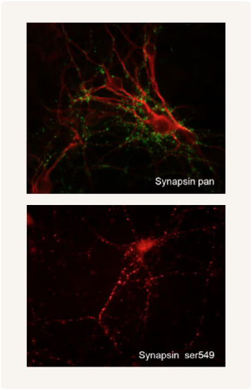Phosphospecific Synapsin Antibody IHC