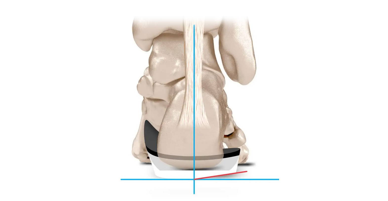 Motion post – KevinRoot Medical