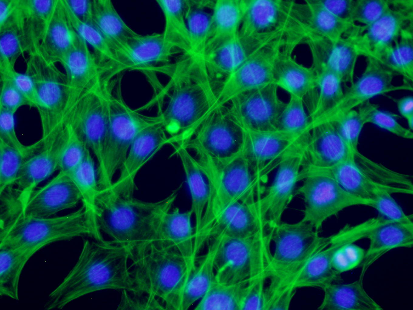 Fluorescence microscopy image of mouse cells growing with recombinant human fgf2 fgf-basic Future Fields
