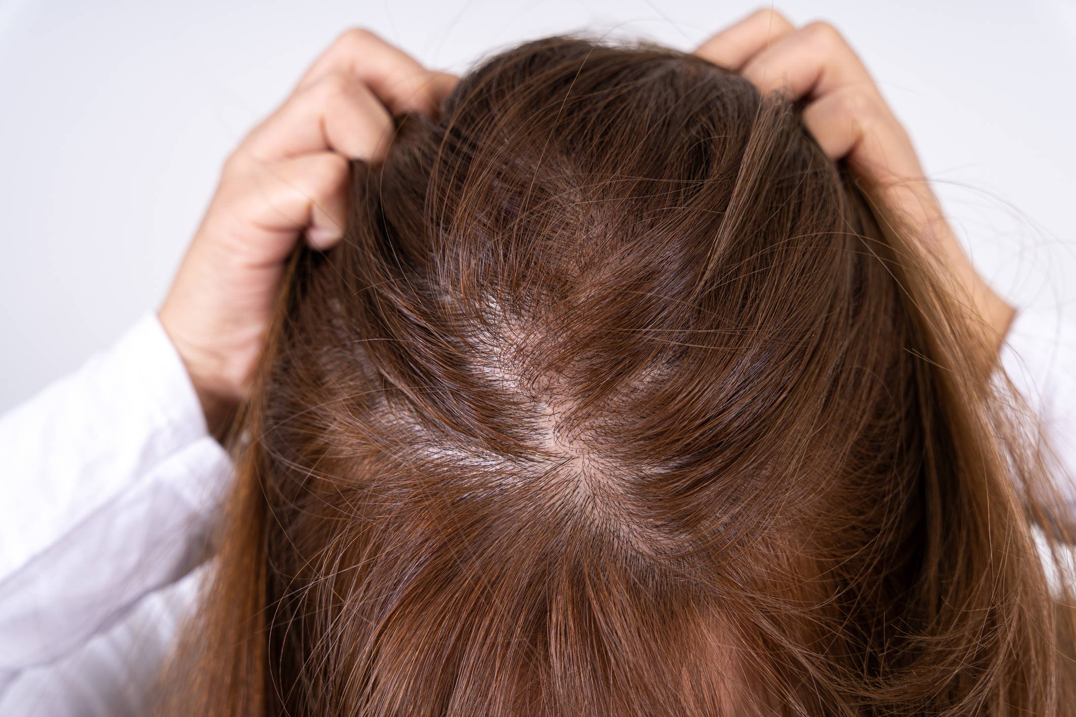Does Perimenopause Cause Hair Thinning? – DS Healthcare Group