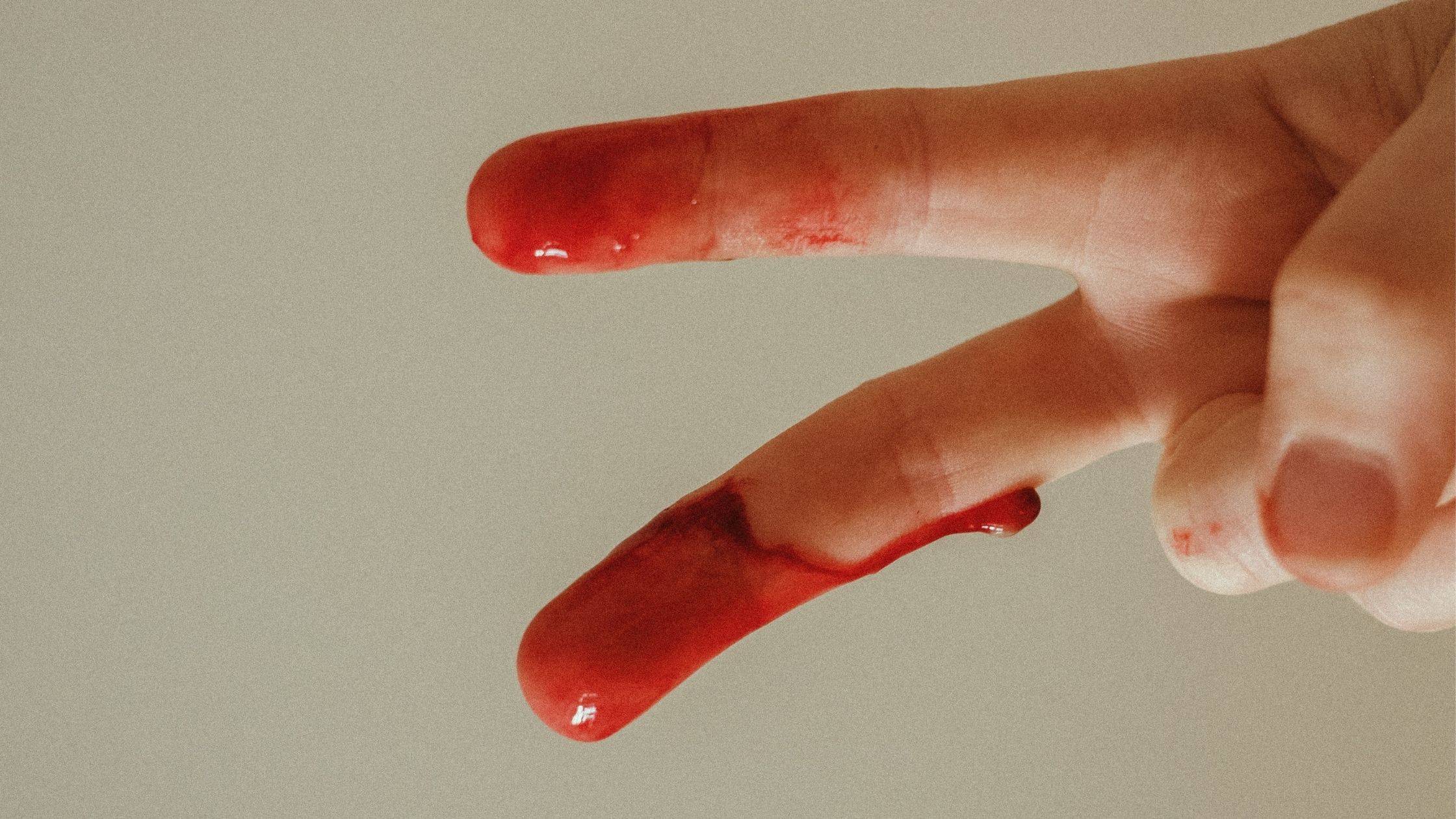 Blood on hand
