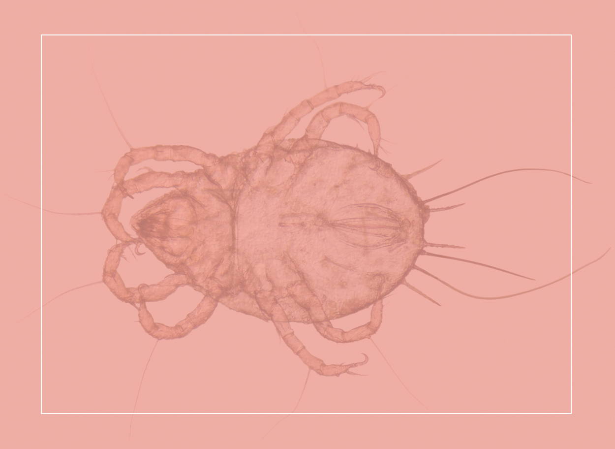 Close-up of a dust mite under the microscope. This cousin of the spider has eight legs and jaws to grab your shed skin