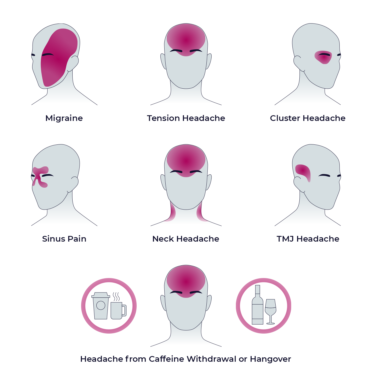 TheraICE Headache Relief Cap Ubiquitrip
