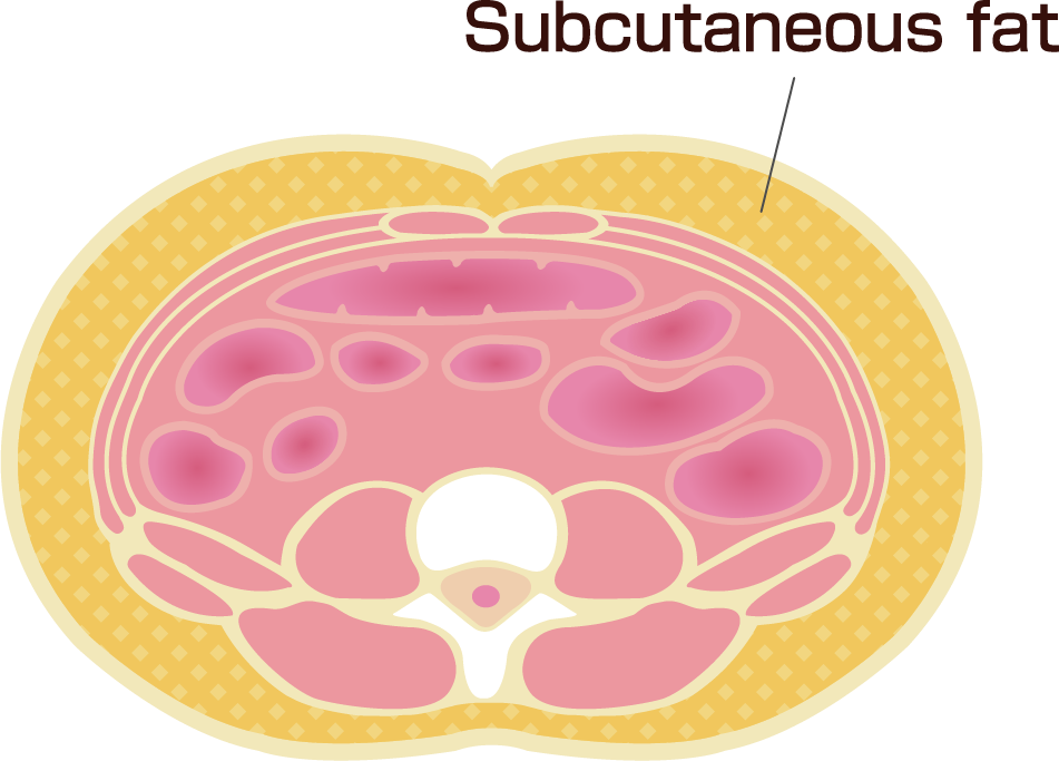 Illustration of subcutaneous fat layers in cross-section.