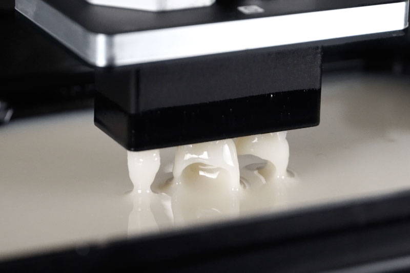 Couronnes imprimés en 3D en 1 heure