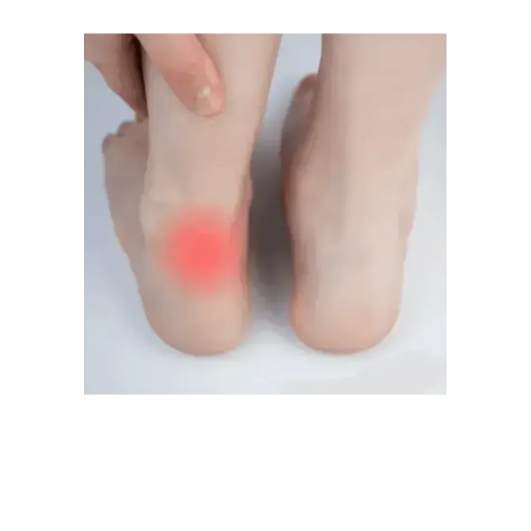 achilles tendittis and VKTRY Insoles