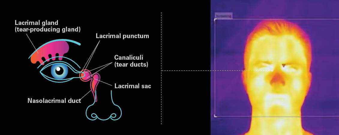Elevated skin temperature screening and its key role in the fight against COVID-19