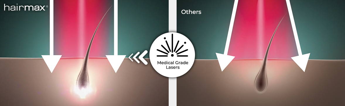 Lasers verses LEDs
