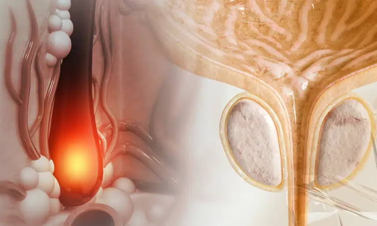 DHT also influences prostate tissue