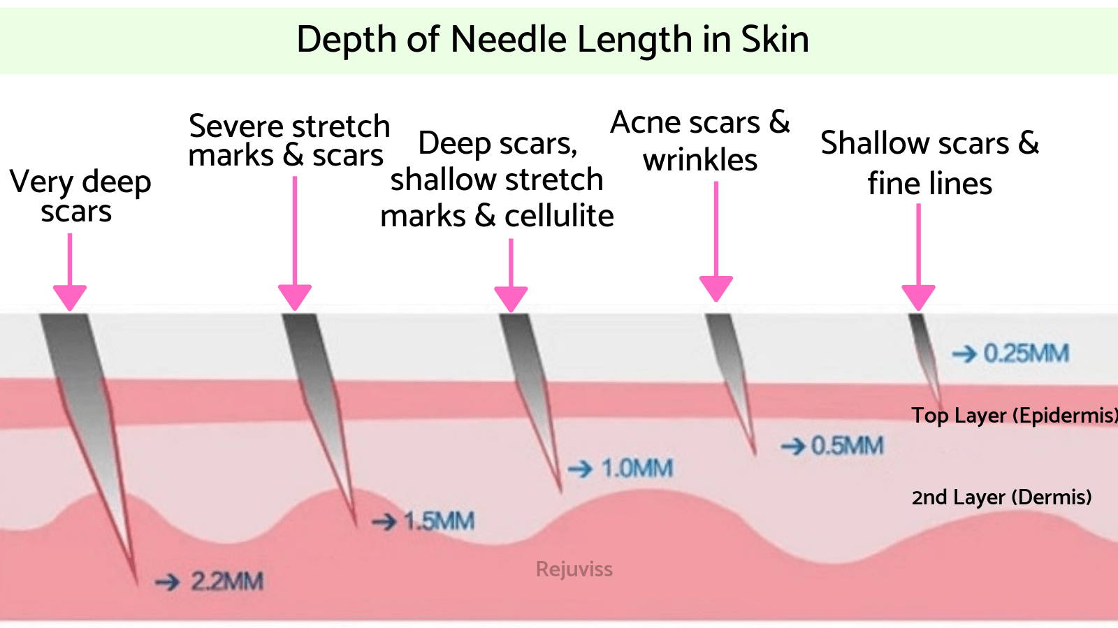 Needle Depth Chart