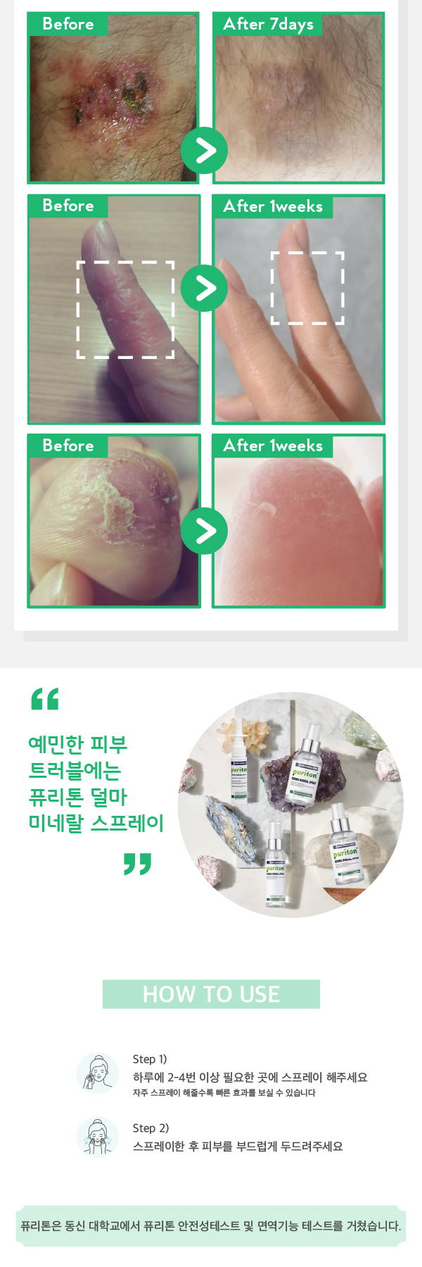 퓨리톤 덜마 미네랄 스프레이 리퓨 예민한 피부 트러블에는 퓨리톤 덜마 미네랄 스프레이 how to use 