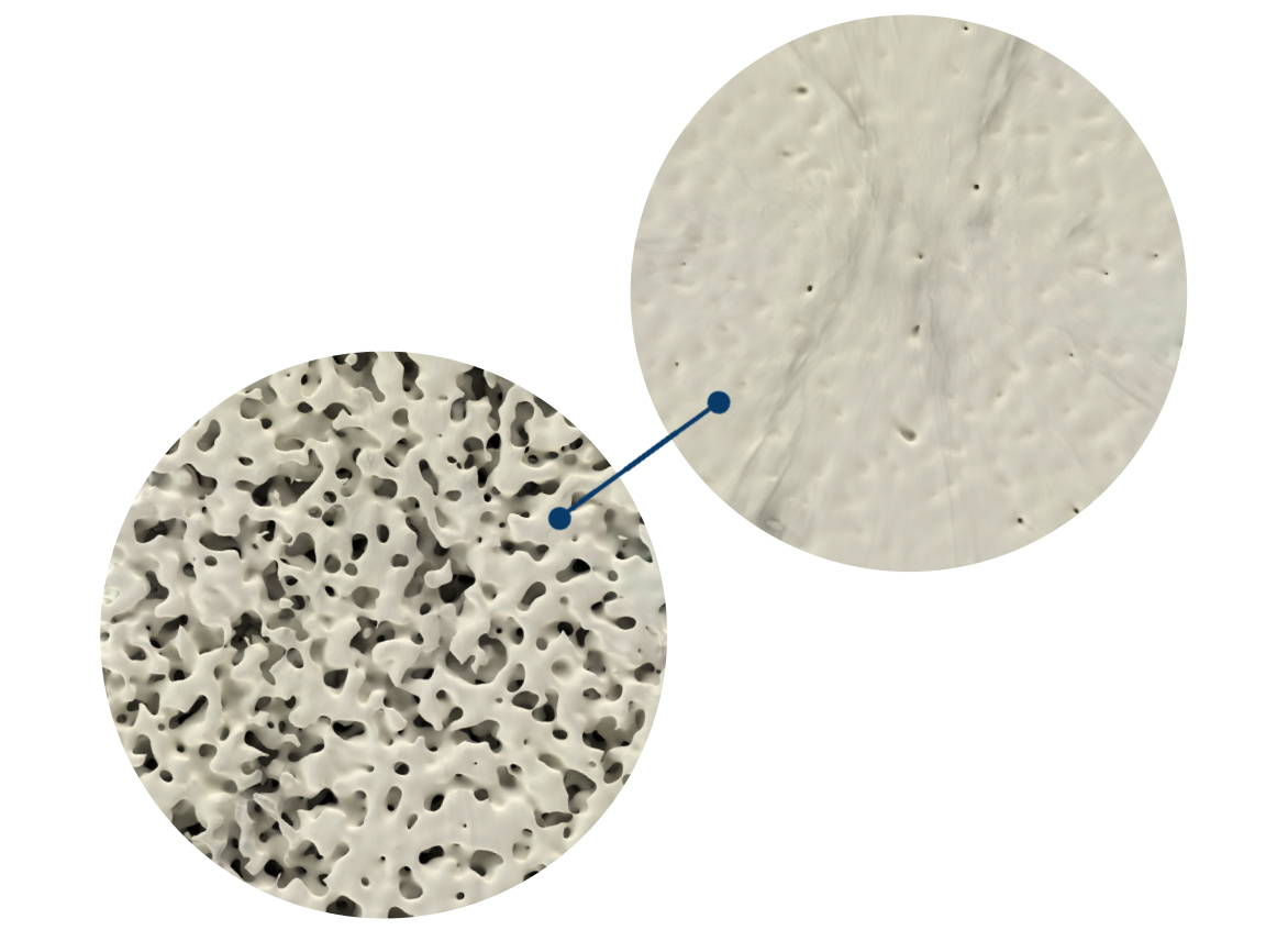 Before and after image of a bone