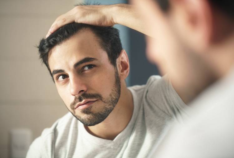 tratamiento anticaída patrón masculino calvicie alopecia
