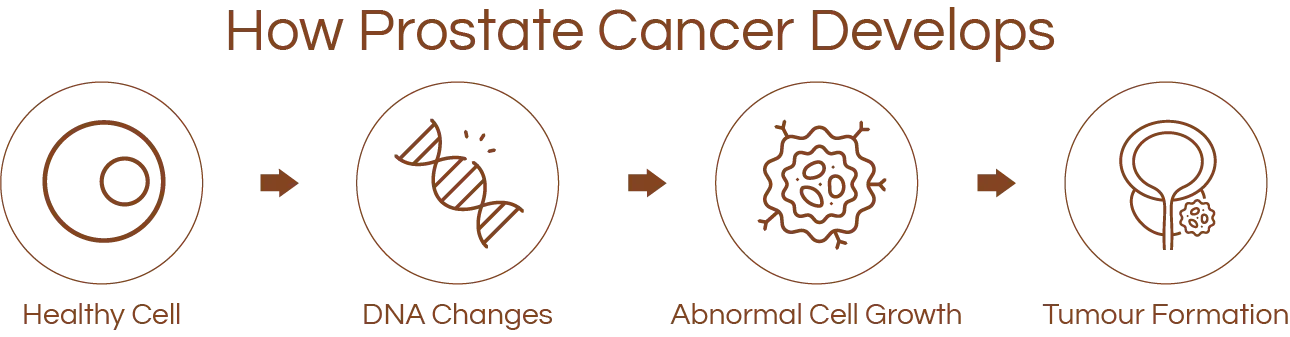 How prostate cancer develops: mutation, alteration, proliferation, and metastasis.