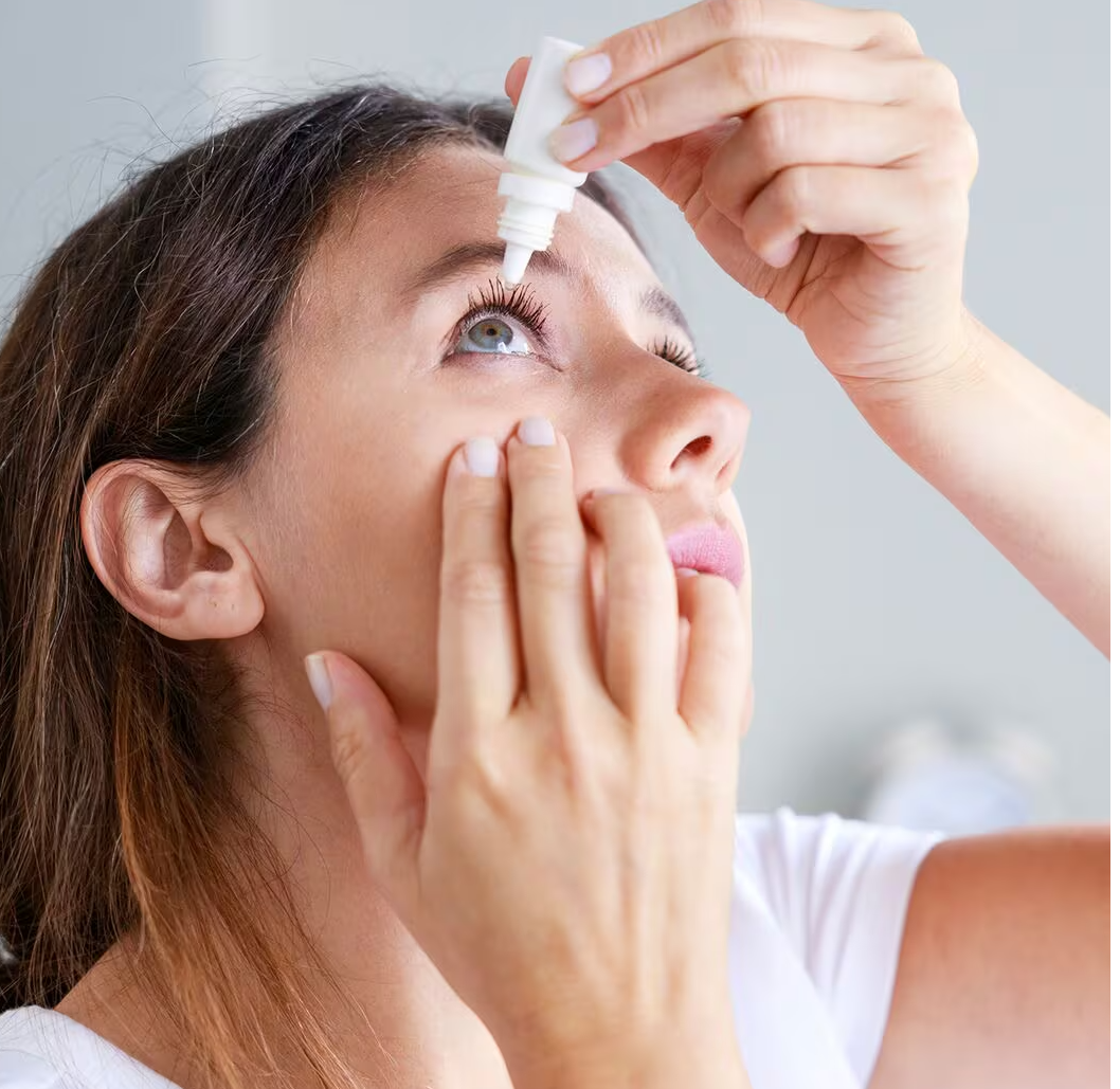 Žena dívající se vzhůru si kape oční kapky ke zmírnění příznaků alergie, které pravděpodobně způsobuje poletující pyl, roztoči domácího prachu nebo alergeny domácích zvířat