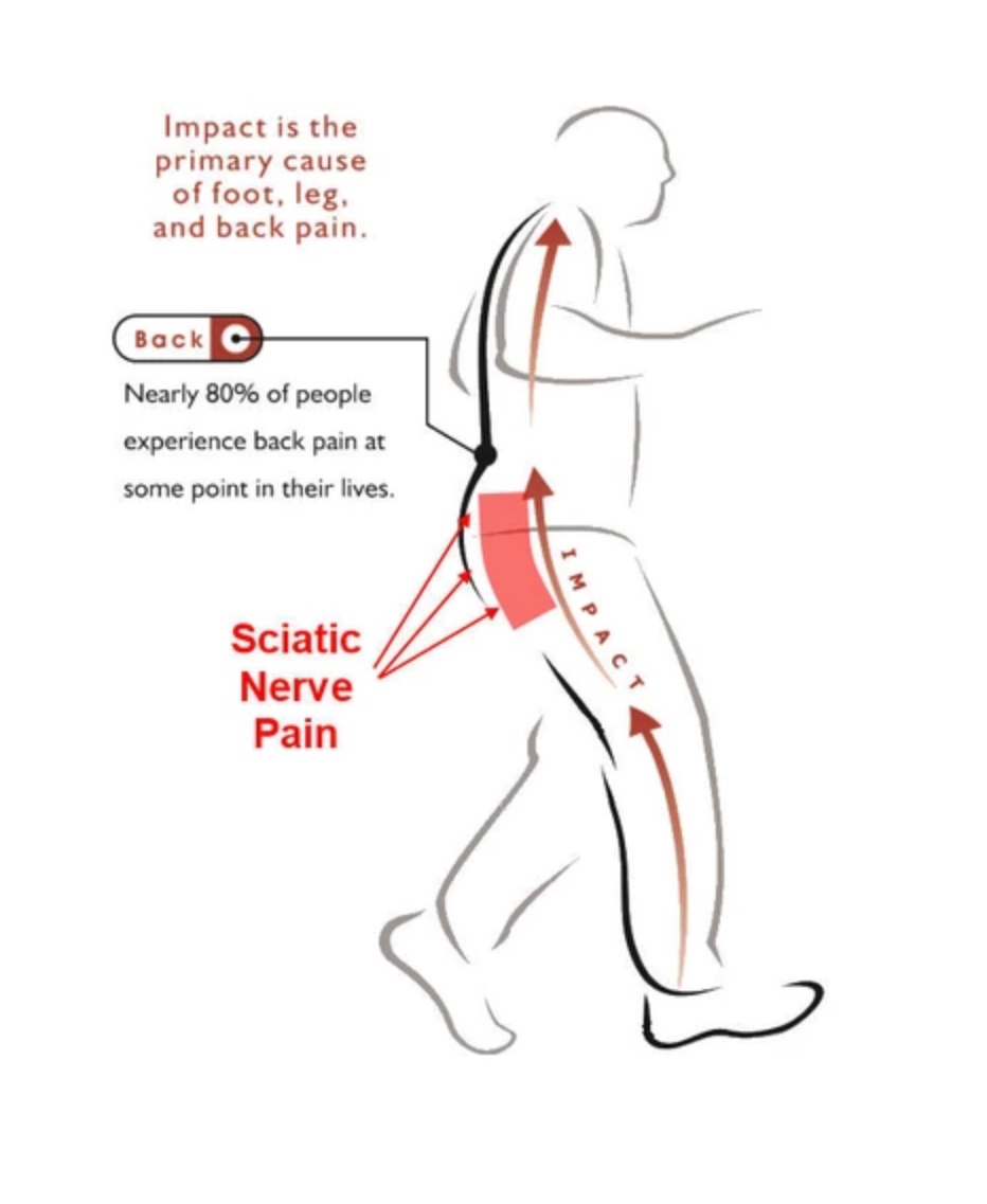 What Is The Treatment For Sciatica Nerve Pain