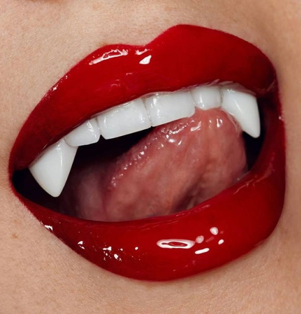 Lip Filler At Prolase