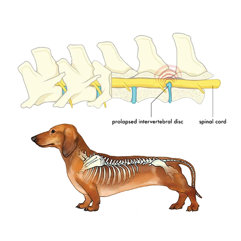 Infographic showing IVDD and a prolapsed intervertebral disc