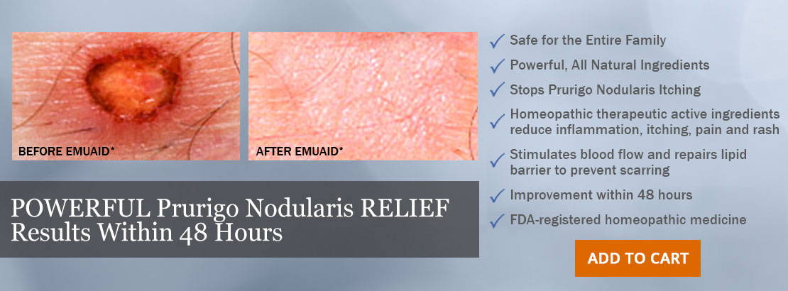 This is an infographic about the before and after results of EMUAID®.