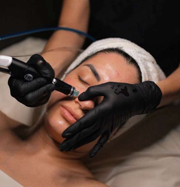 Hydrafacial at skin Deep