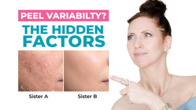 Why Your Peel Didn't Work - And How to Fix it