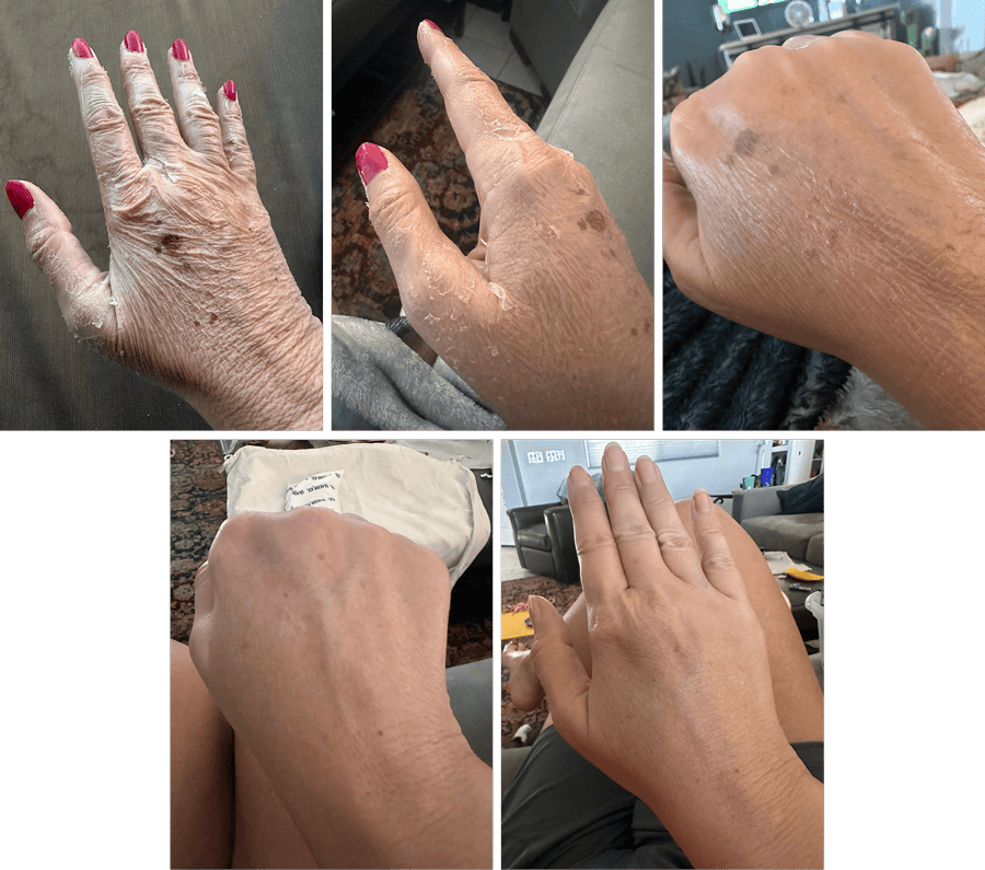 Various hands showing different skin tones and conditions.