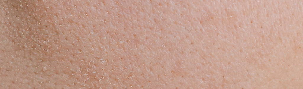 Dehydrierte Haut