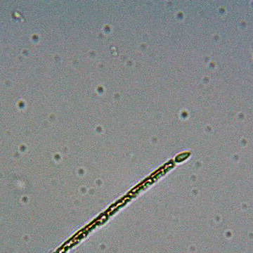cylindrospermopsis-under-microscope