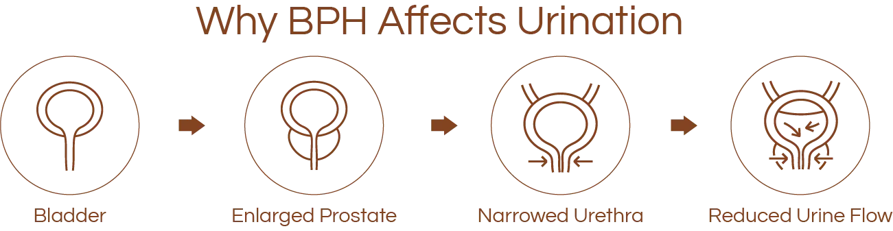 Icons illustrating Why BPH Affects Urination
