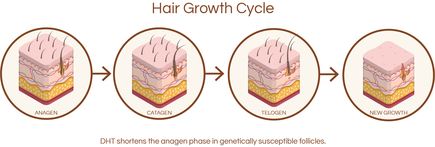 Illustration of the hair growth cycle: anagen, catagen, telogen, new growth.