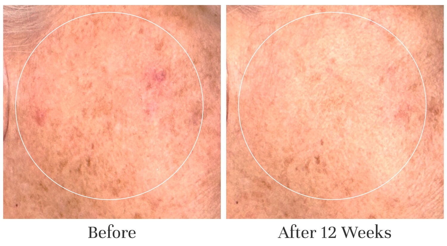 Comparison of skin appearance before and after 12 weeks of treatment.