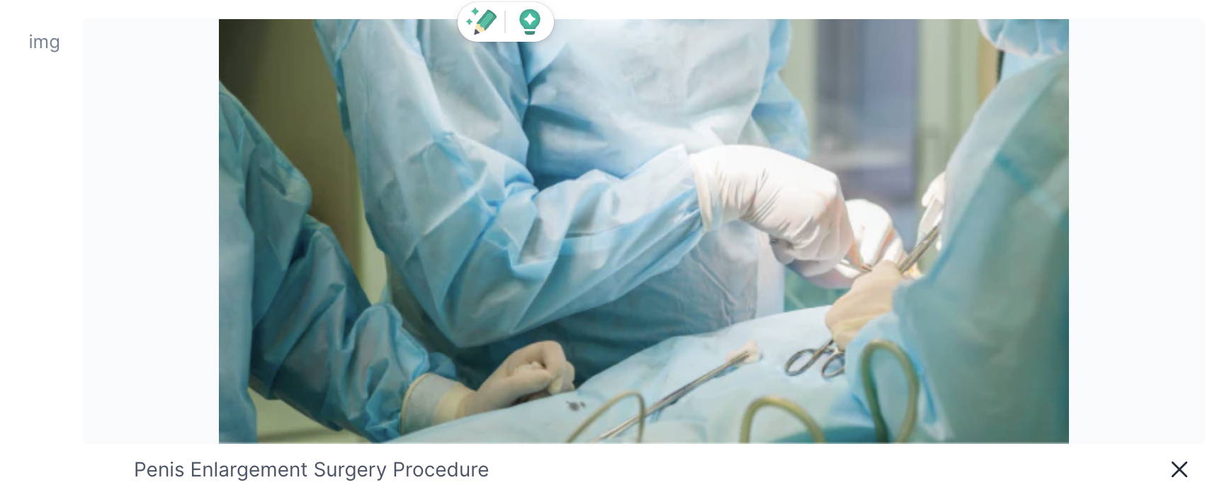 Penis Enlargement Surgery Procedure