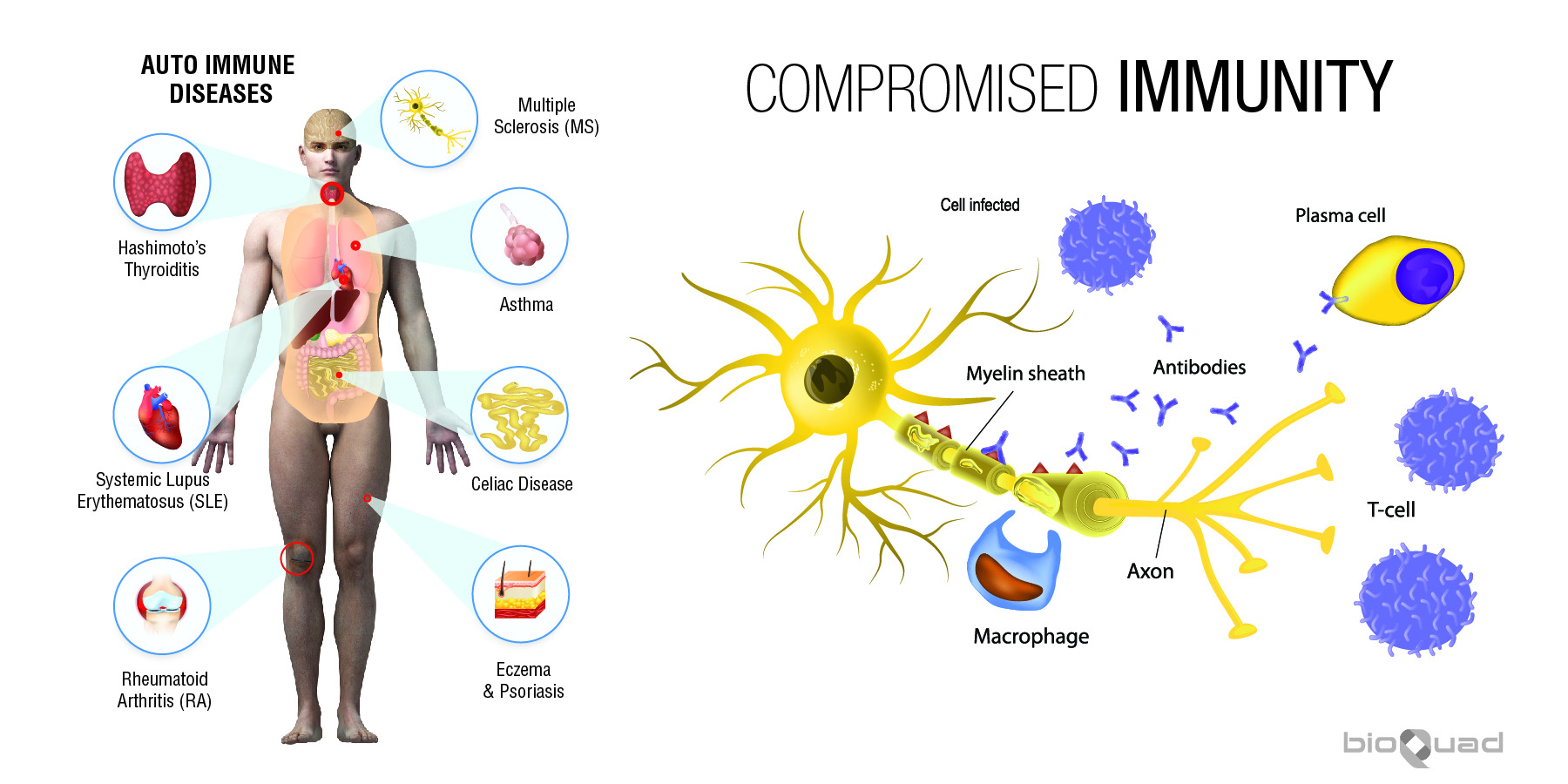 Immune System — Bioquad Life Sciences