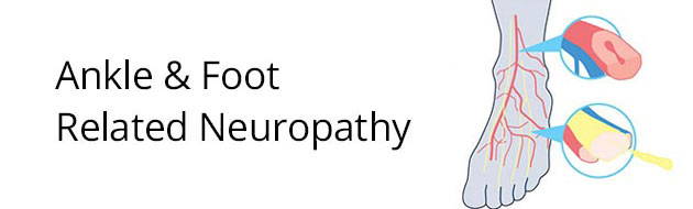 Ankle and foot related neuropathy