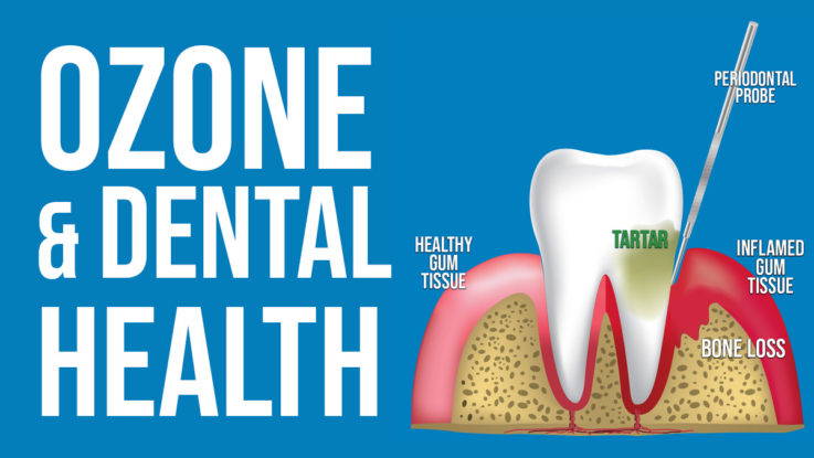 Ozone and Dental Health