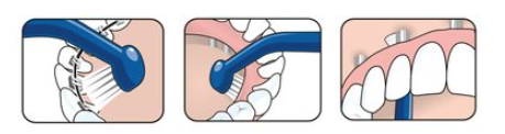 TePe Implant Orthodontic™ - Toothbrush for Dental Implants – TePe USA