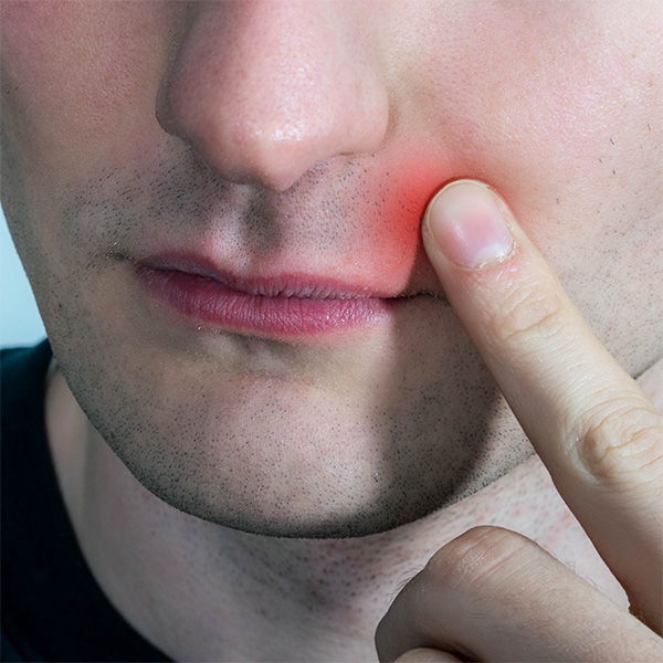 Person touching their cheek with a finger, highlighting a red spot.