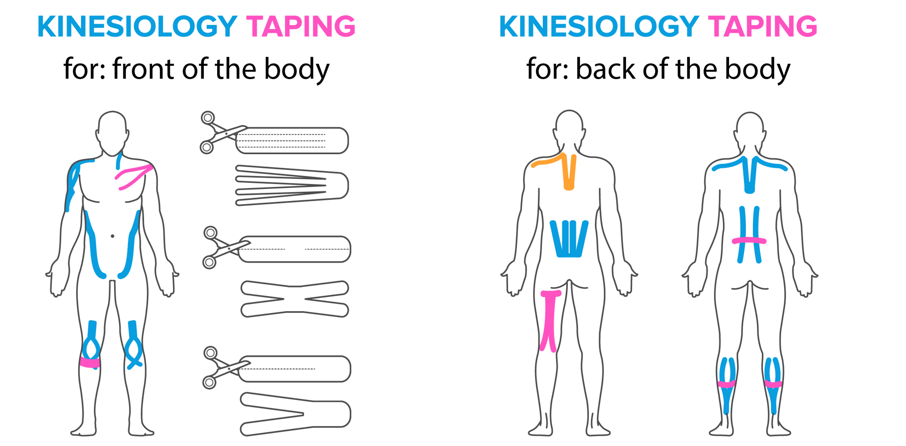 How To Apply Kinesiology Tape