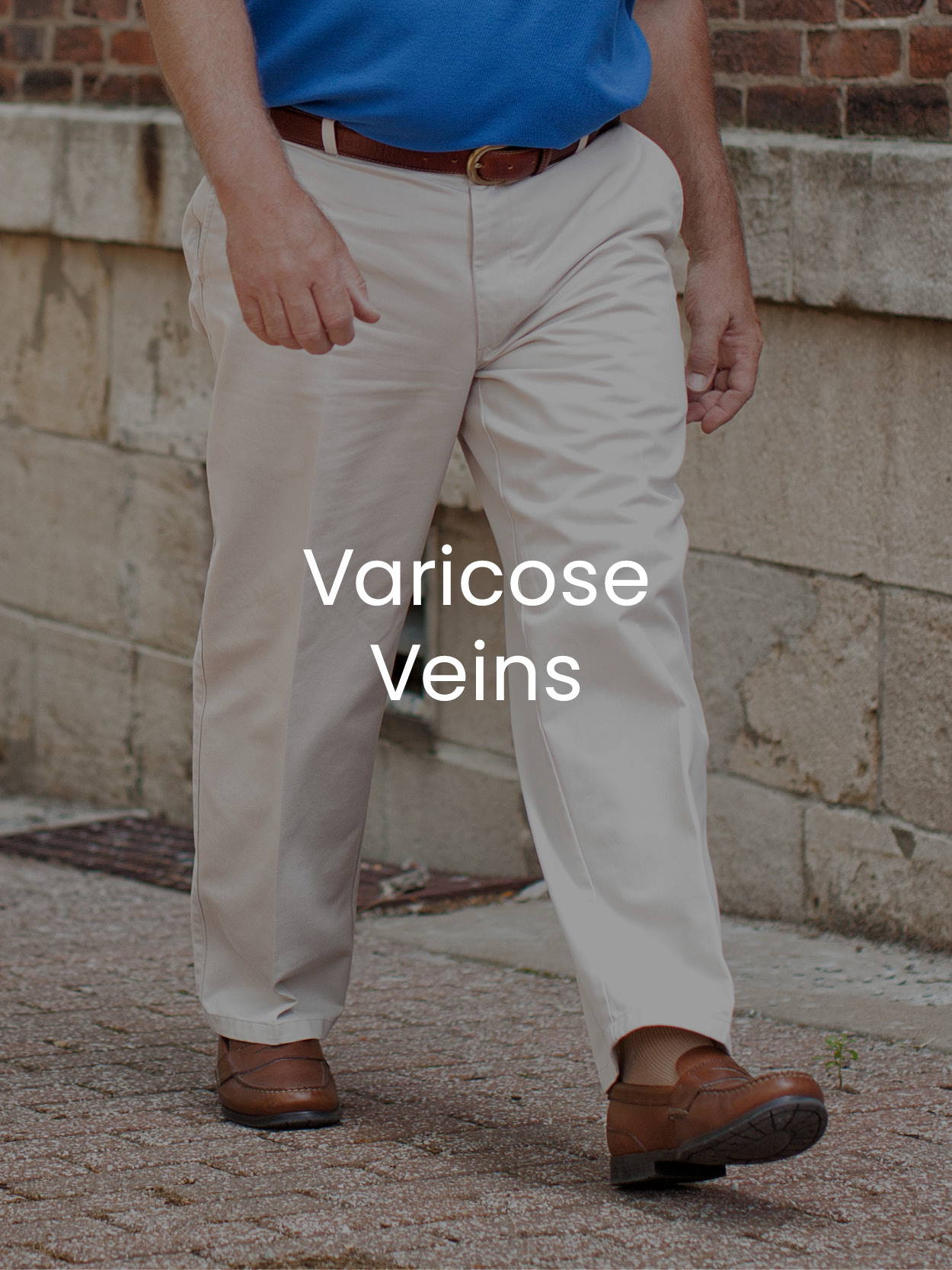 Varicose Veins