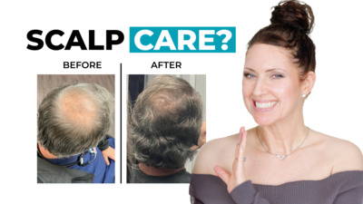 The No-Fuss Scalp Routine for Balding Men