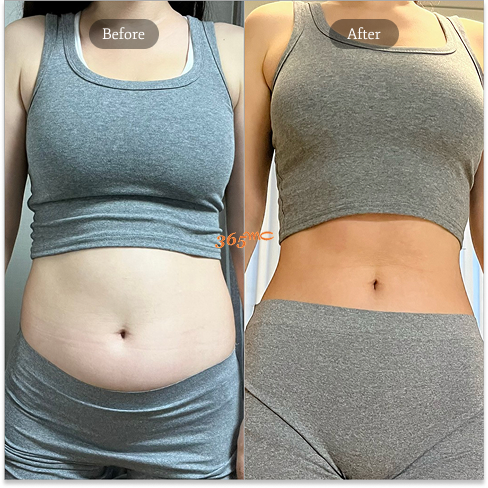 Non-Surgical Body Contouring in Korea with Fat Dissolving Injections for Waistline Slimming and Stubborn Fat Reduction