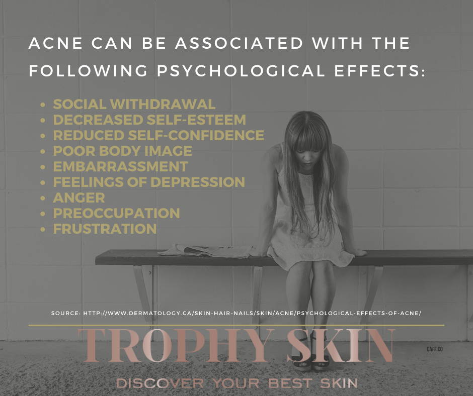psychological effects of acne 